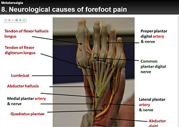Neurological Causes of Forefoot Pain